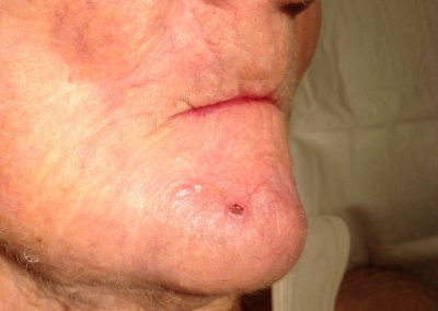 BSC CLinical Pic 111