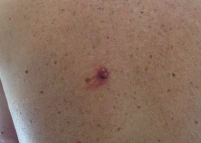 BSC CLinical pic 114