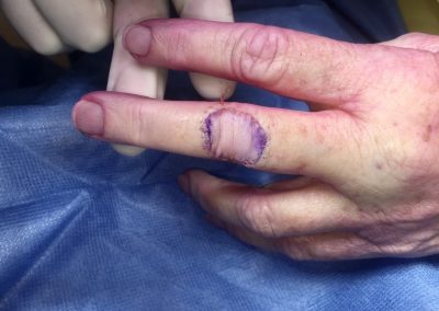 BSC CLinical pic 117