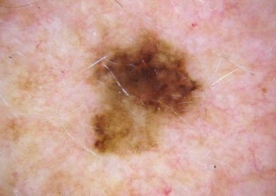 BSC Clinical Pic 103