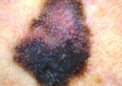 BSC Clinical Pic 109