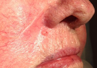 BSC Clinical Pic 115