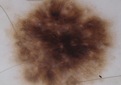 BSC Clinical pic 116